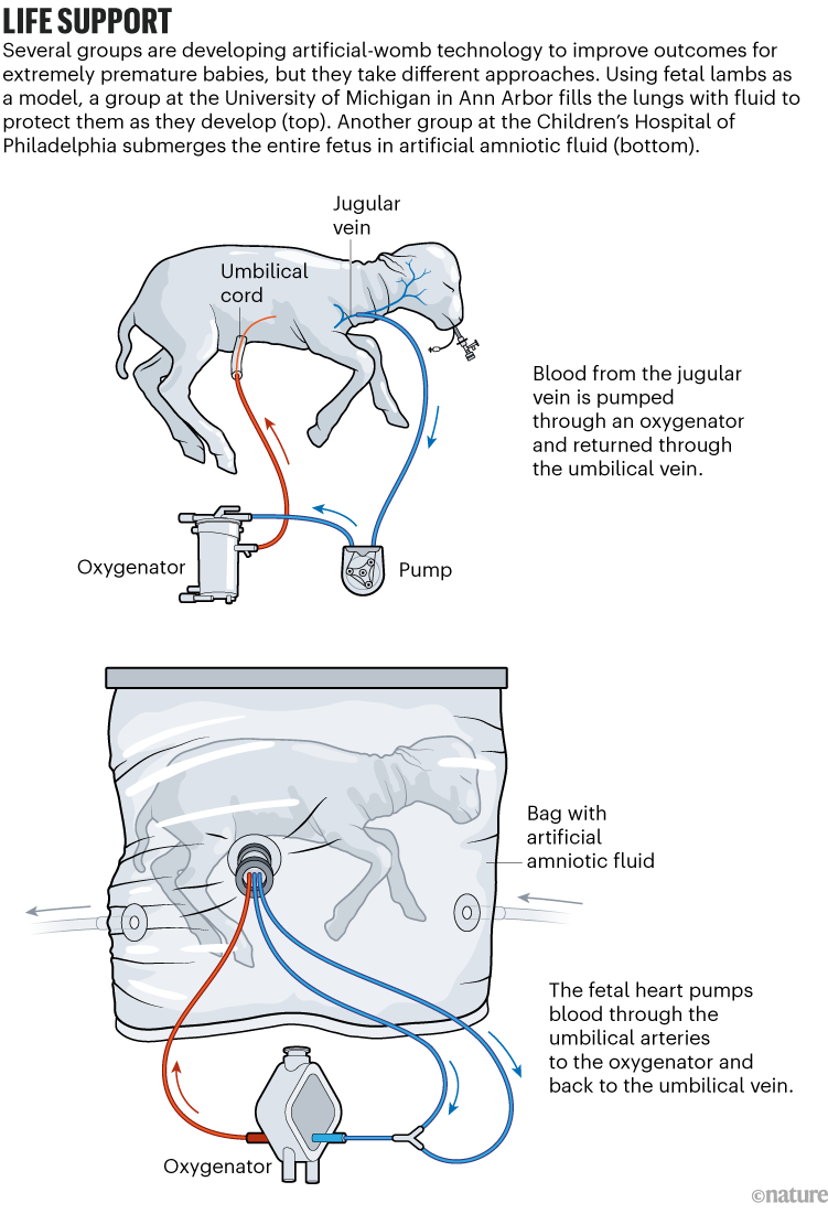 Human trials of artificial wombs could