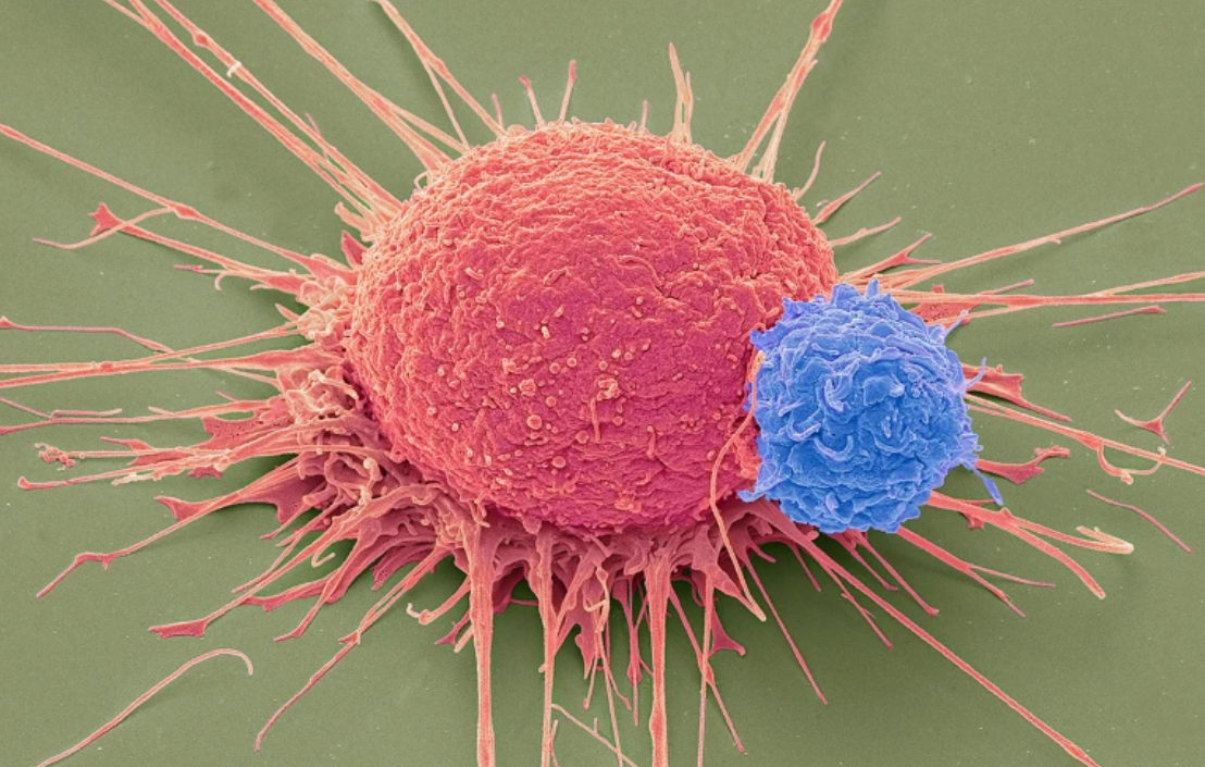Cancer-fighting CAR T cells show promising results for hard-to-treat tumours