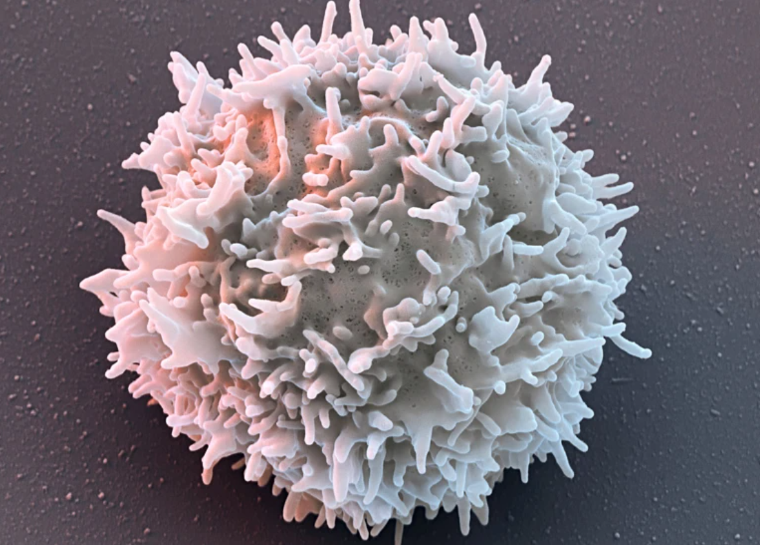‘They don’t have symptoms’: CAR-T therapies send autoimmune diseases into remission